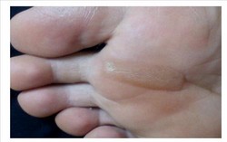 thumbimg